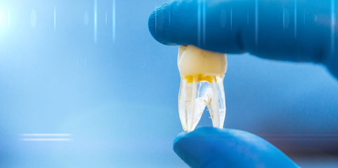 Studio dentistico con impianto ai denti per molari e premolari. Panoramica. Banner. Spazio per...