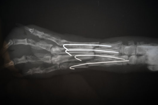 Radiography of a dog paw. Real x ray image of an injured dog paw .