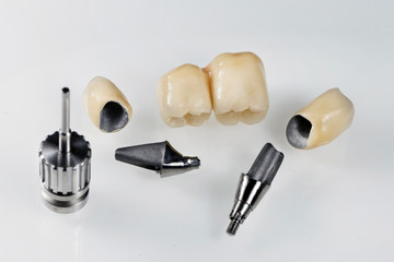 excellent photograph of dental crowns for prosthetics with the basis for installation