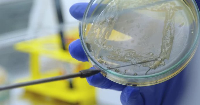 Close-up microbiologist with a bacterial loop collects bacteria culture from a petri dish. Conduct a microbiological loop through the bacteria. The bulky mass of bacteria cells.