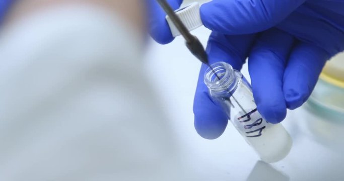 A scientist adds bacteria from a Petri dish to a glass tube using a microbiological loop. Dilute the thick mass in water. Cultivation of microorganisms. Preparation for the cultivation of bacteria.