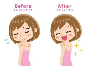 背中　ニキビ　湿疹　ビフォーアフター