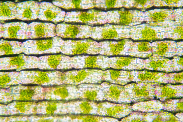 Plant cell under the microscope view.