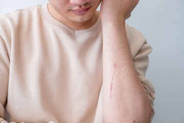 Men feel pain in the arms caused by accidents.