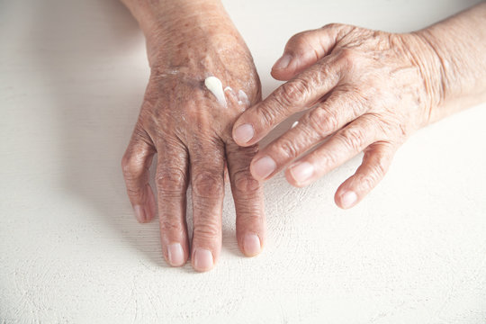 Elderly woman applies the cream on the hand.