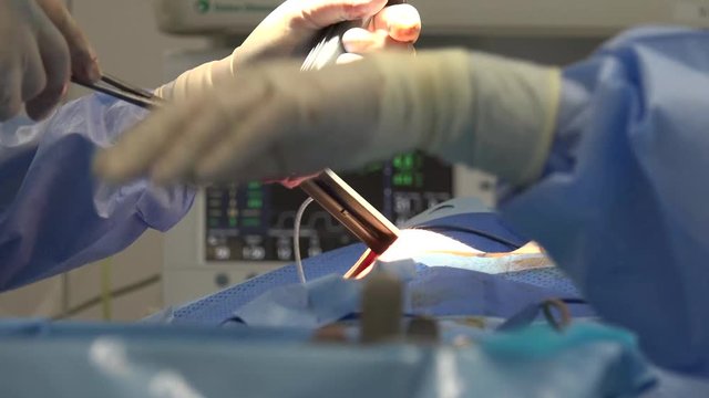 Breast augmentation are plastic surgery terms for the breast-implant and the fat-graft mammoplasty approaches used to increase the size and alter the texture of the breasts of a woman.