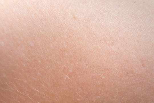Macro of human skin. Human skin texture
