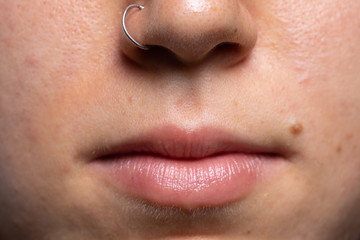 Fototapeta premium A close up view on the soft lips and face of a young Caucasian girl with pierced nose ring. Pimples and spots in the skin of a young adult in her twenties.