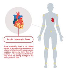 Acute rheumatic fever illustration concept