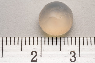 close-up photo of a cat eye lens