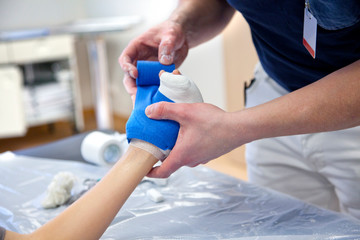 doctor bandaging plaster cast to kids broken hand bone in hospital