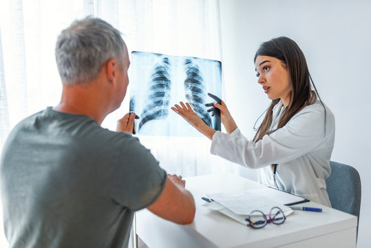 Young doctor talking to a patient in her cabin. Doctor showing x-ray to patient. Doctor and patient looking at Xray in medical office. Doctor shows the patient chest x-ray