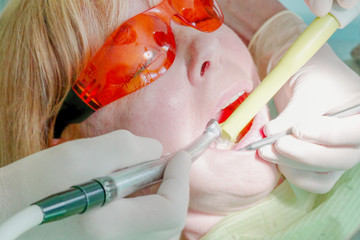 Dentist remove tooth decay in and around the cavities and use dental suction.