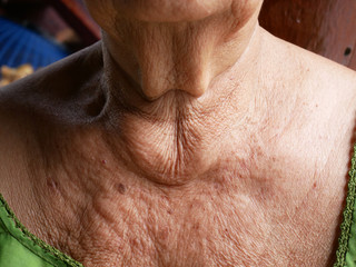 Naklejka premium Close-up skin of an elderly woman.