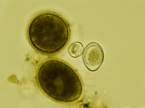 Two eggs of Toxocara cati and two oocysts of Isospora felis under the microscope