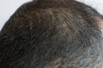 Cropped shot view of Asian men head with few grey hair growing. Hair turns white when the pigmentation cells responsible for colour (melanin) stop being produced. 