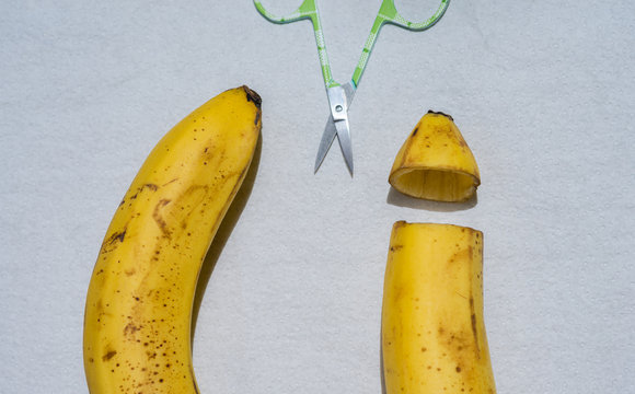 two bananas simulating a phimosis operation