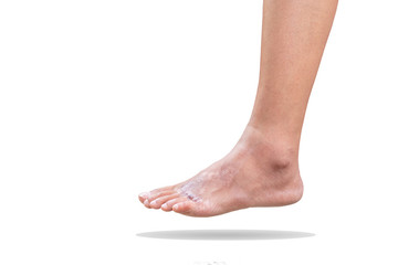 The foot that is the accident scars of woman isolated on white background.