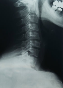 x ray of the neck