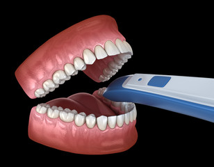 Intraoral Teeth 3D scanner. My own design. 3D illustration concept
