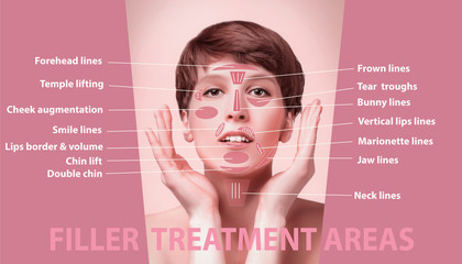 The areas for rejuvenation cosmetological injections