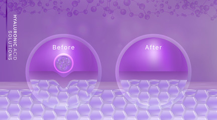 Hyaluronic acid before and after skin solutions ad, purple collagen serum drop with cosmetic advertising background ready to use, illustration vector.