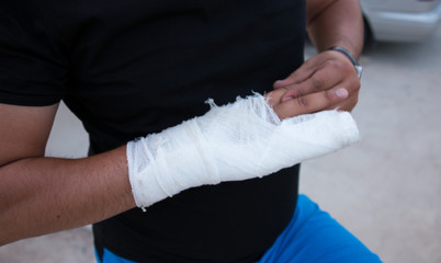 Man's arm in cast and sling