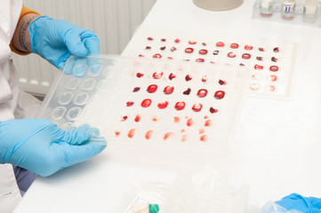 Blood pallet in laboratory.  Blood test in clinic