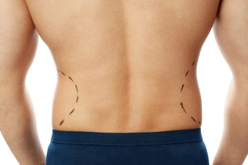 Fototapeta na wymiar Young man with marks on body for cosmetic surgery operation against white background, closeup