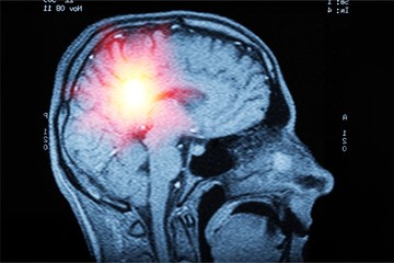 Brain.