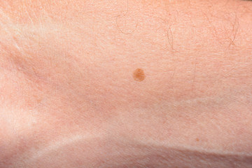 Fototapeta premium Male hand with age spots in retirement age