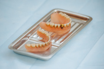 Close-up an acrylic denture prosthesis of the upper and lower jaws of a man
