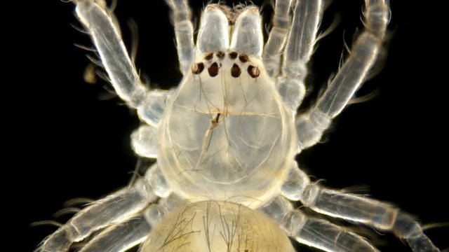 spider under a microscope, Arachnida class, Arthropoda squad, Spiders are predators, feed primarily on insects or other small animals, the size of this spider is about 3 mm