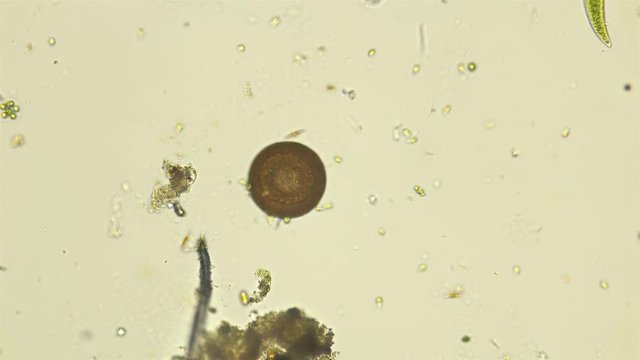 Arcella's amoeba under a microscope, usually found in fresh water and mosses, feeds on diatom algae, single-celled green algae or protozoa such as flagella and ciliates