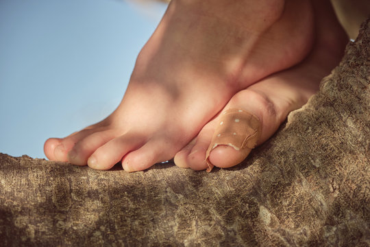 Baby bare feet with band-aid on brown tree trunk on sunny day