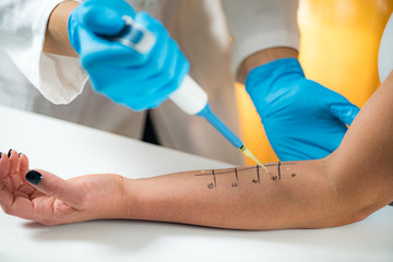 Allergy - Skin Prick Testing
