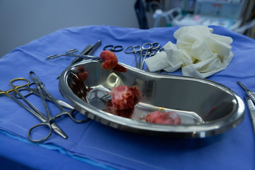 Surgical instruments and kidney dish on a table in operation room of hospital