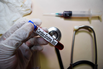 Cardiac Enzime Test text on Sticky Notes. Top view isolated on office desk. Healthcare/Medical...