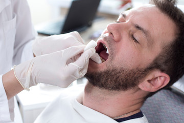 Twarz białego mężczyzny z otwartymi ustami na fotelu dentystycznym. Dłonie lekarza w białych rękawiczkach zmieniają wałek z ligniny w ustach pacjenta.