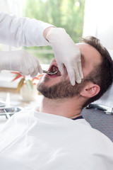 Ekstrakcja zęba u białego mężczyzny. Dłonie lekarza trzymają kleszcze i łapią zęba. 