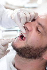 Dłonie dentysty w białych rękawiczkach trzymają wydrążacz dentystyczny i badają zęby u białego mężczyzny z lekkim zarostem.  - obrazy, fototapety, plakaty