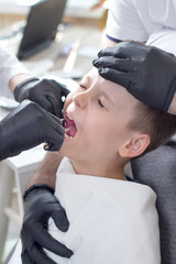 Dziecko z grymasem bólu na twarzy siedzi na fotelu dentystycznym podczas wyrywania zęba. Dłonie lekarza wyrywają ząb kleszczami a asystent trzyma głowę pacjenta.