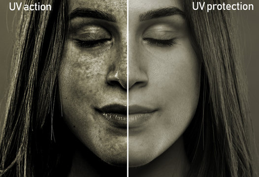A split screen showing the results of sun rays on the soft face of a girl in her early twenties. After effects of skin with and without UV protection.