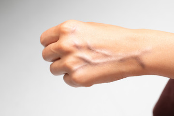 A close up view on the back of a Caucasian hand. Bulging veins are seen close to the surface of the skin, isolated against a clean white background. - obrazy, fototapety, plakaty