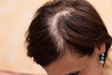 A high angled and closeup view on the top of the head of a lady with brown hair. A large parting...