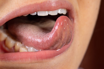 A closeup view on the mouth of a young Caucasian woman sticking her tongue out and curling it up towards the teeth. Oral health and wellness. - obrazy, fototapety, plakaty
