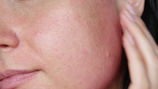 Skin texture with enlarged pores. A woman touches her face, making a massage close-up. Problem skin care, anti-aging care.