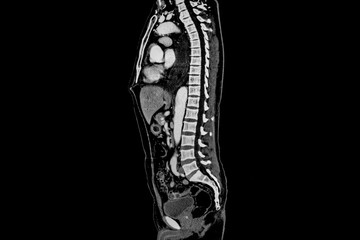 Computer tomography angiography :CTA of whole body scan with 3D reconstruction .CT angiography for determine vascular disease / trauma . Technology Concept.