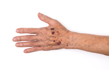old man's sick hands on white background