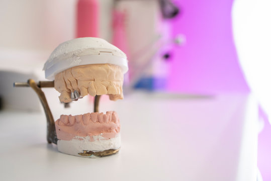 Isolated dental mold on white surface.